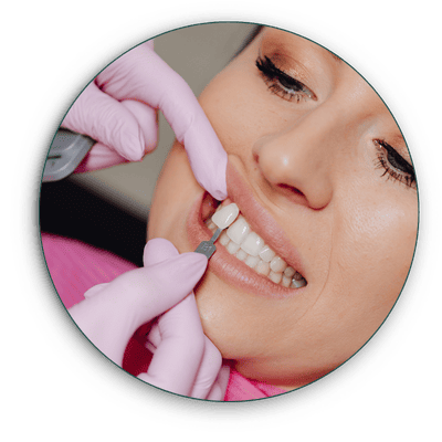implantes-dentarios