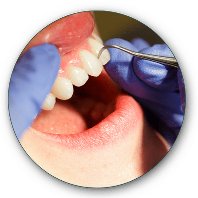 limpeza-dentaria-saúde-bucal